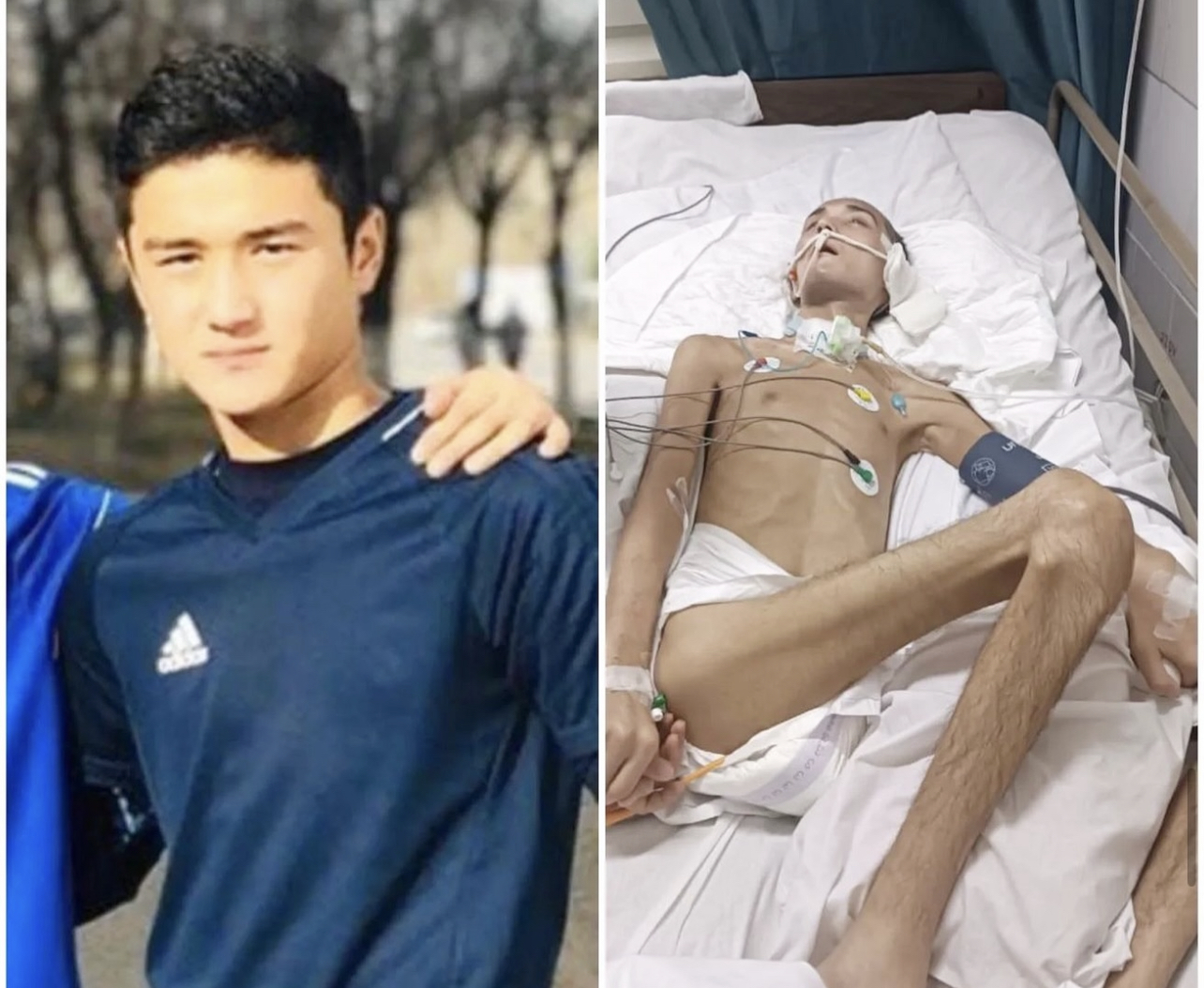 Казахстанцы собрали почти 140 млн тенге на лечение солдата Ербаяна Мухтара