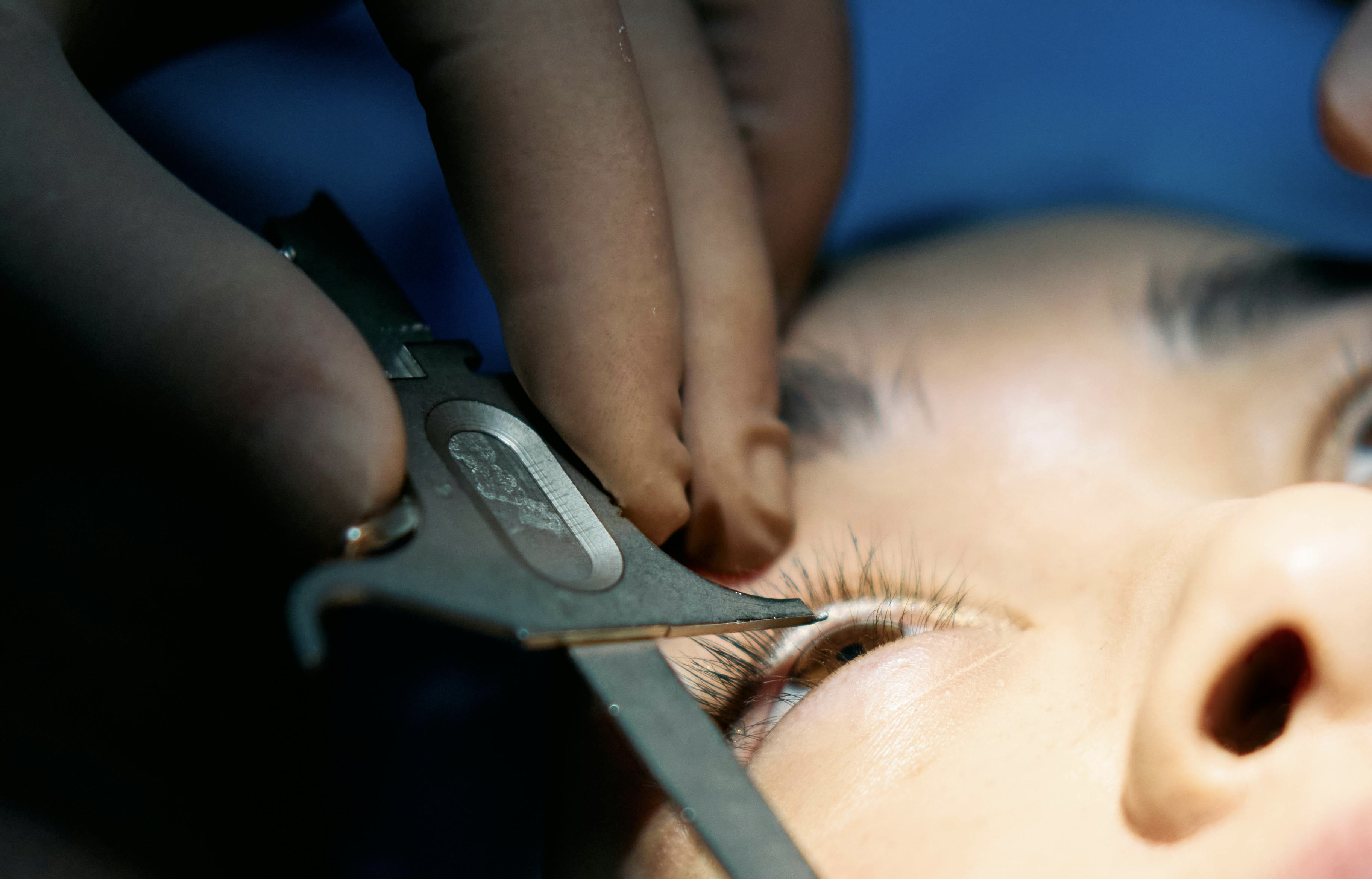 Пациентка ослепла на один глаз после пластической операции в Шымкенте